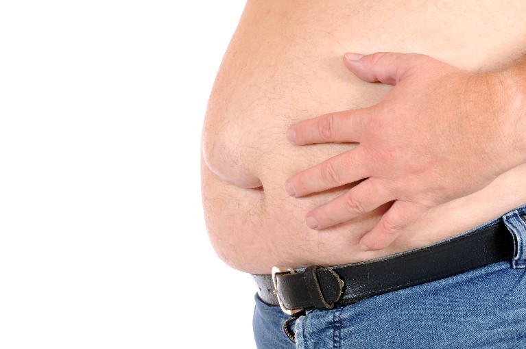 האם יש קשר בין סרטן השד אצל גברים לבין השמנת יתר? - מחקר בדק